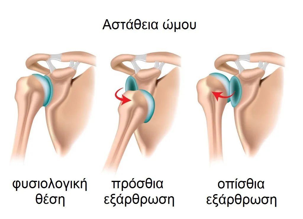 Φυσικοθεραπεία στην αστάθεια του ώμου (Shoulder instability) 2 Αστάθεια ώμου ανατομία