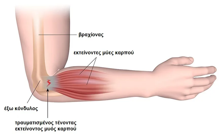 Φυσικοθεραπεία στην επικονδυλίτιδα αγκώνα (Elbow epicondylitis) 2 Επικονδυλίτιδα αγκώνα ανατομία