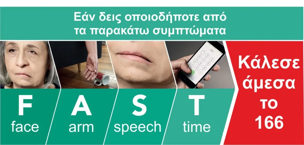Φυσικοθεραπεία στο εγκεφαλικό επεισόδιο (Stroke) 4 Σημάδια εκδήλωσης εγκεφαλικού επεισοδίου