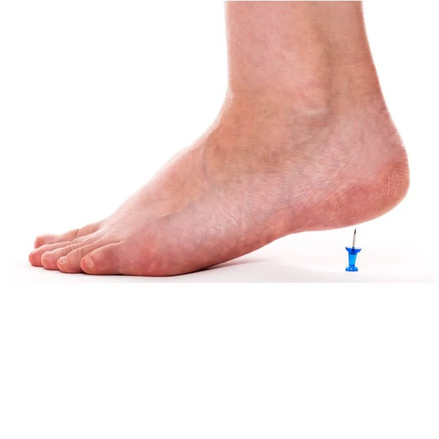 Σημεία πυροδότησης - trigger points 4 Άκανθα πτέρνας