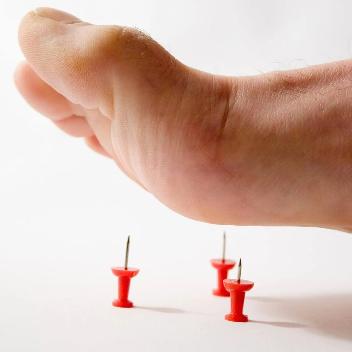Σημεία πυροδότησης - trigger points 5 Πελματιαία απονευρωσίτιδα